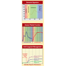 Sonoclot – Hemostasis Management in Critical Care